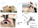 tonometer_diaton_glaucoma_test